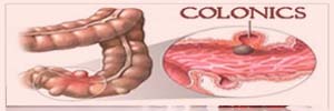 Colonic polyps: colonics & colon therapies.