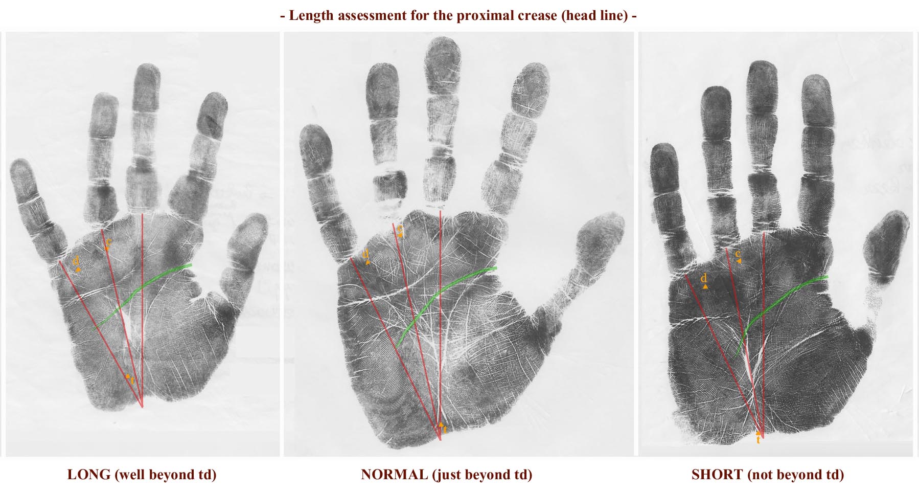 Head line length assessment: td.