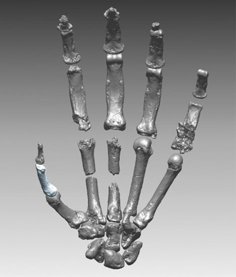 Ardi's hand.