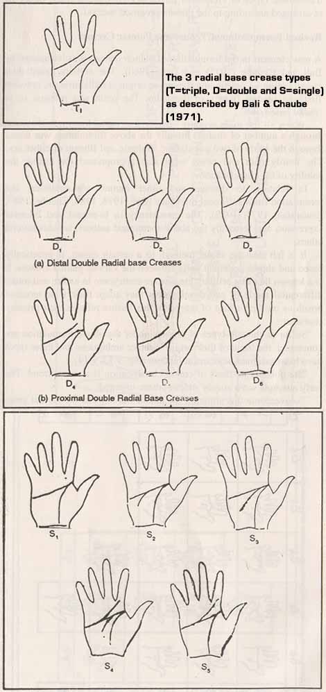 Bali & Chaube (1971) described three radial base crease types.