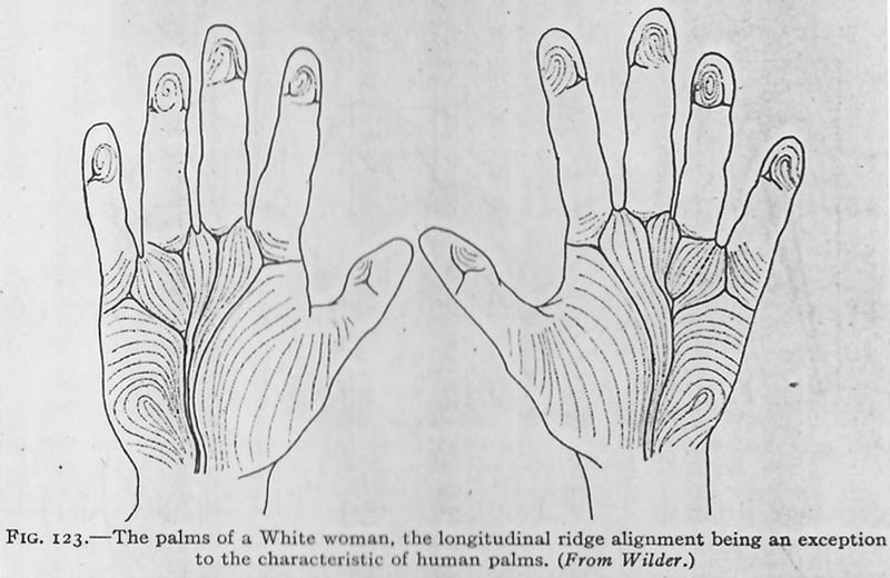 Palms of a white woman, the longitudinal ridge alignment being an exception to the characteristic of human palms.