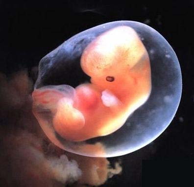 Photo of 7 week old embryo: 48 days.