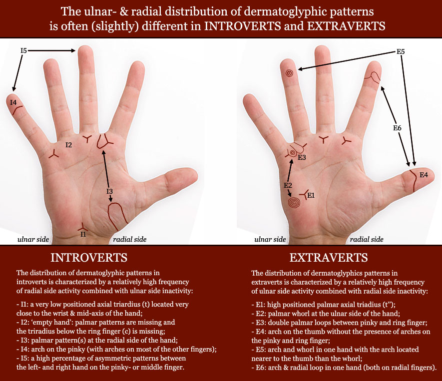 Distribution of dermatoglyphics patterns in Introverts & Extraverts.