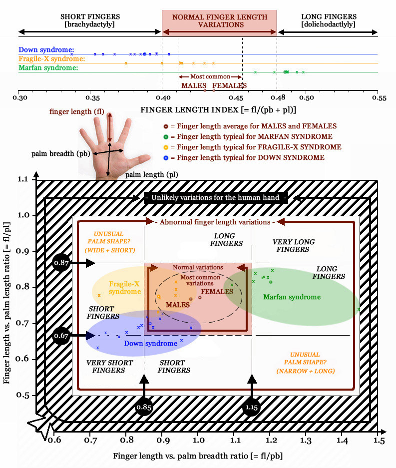 Finger length variations in syndromes: Down syndrome, Fragile-X syndrome & Marfan syndrome.