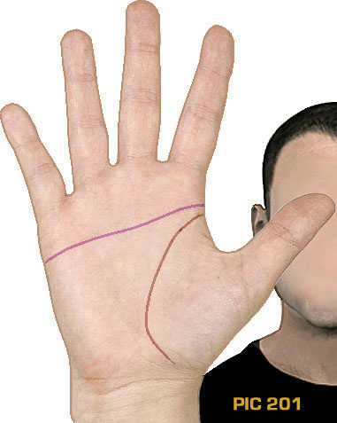 Example of PIC-variant 201: the 'long' simian crease, which is not connected to the life line but does cross the full palm.