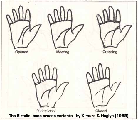 Kimura & Hagiya described 5 radial base crease variants.