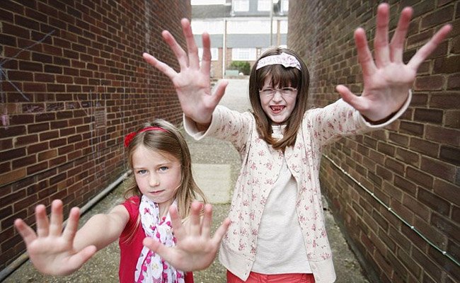Marfan syndrome: large hands in a tall 6 year old child.