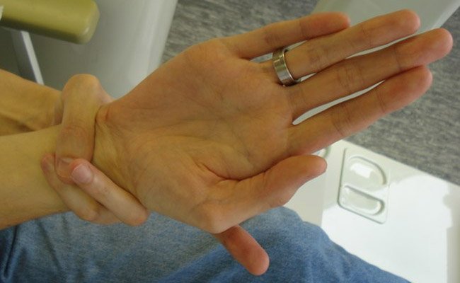 Marfan syndrome: the Walkder-Murdoch sign for the wrist.