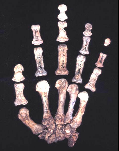 The left hand of 'Neanderthal Shanidar 4'.