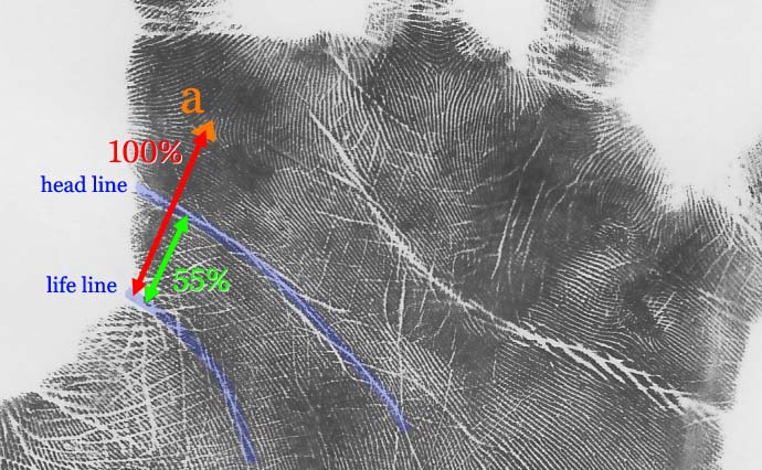 Head line with a large disconnection: located at 55% of the distance between the life line and the a-triradius.