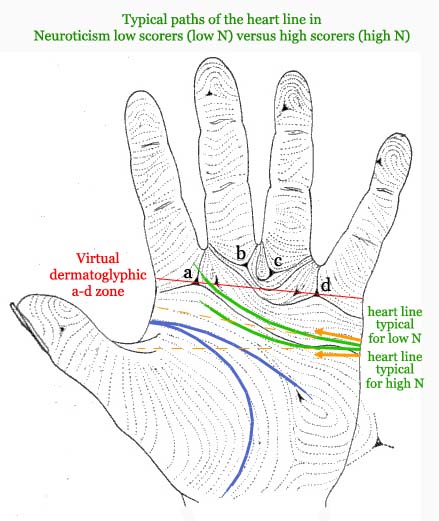 Typical path of the heart line in Neuroticism low scorers versus high scorers.