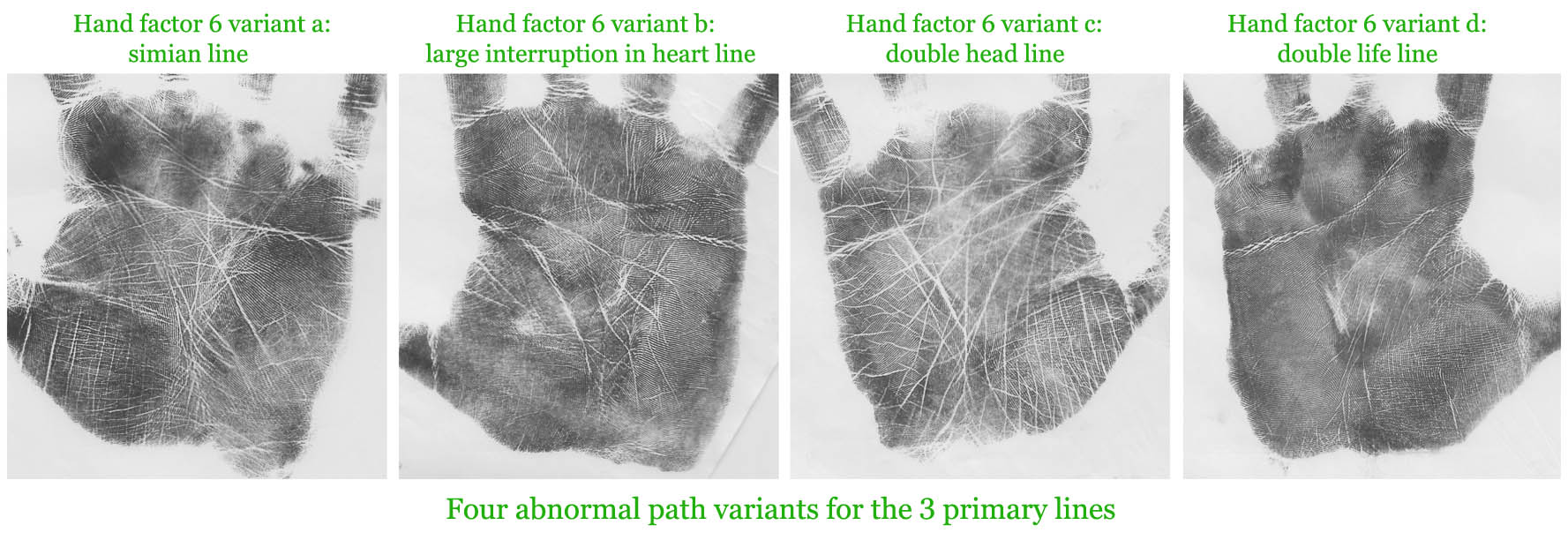 4 Abnormal path variants for the 3 primary lines.