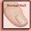Brittle Fingernails & Toenails