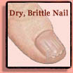 Brittle Fingernails & Toenails