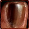 A brown nail plate
