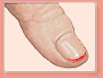 The free edge of the fingernail: nail colour disorders.