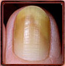 A yellow nail plate