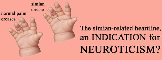 Neuroticism: abnormal hand lines & the simian crease.