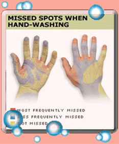 Hand hygiene: missed spots when hand washing!