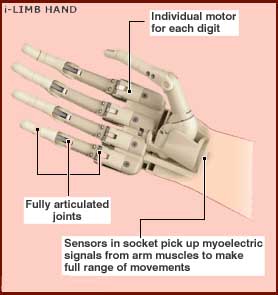 bionic hand for toddler