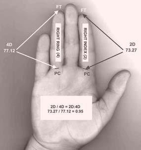 How to measure digit ratio.