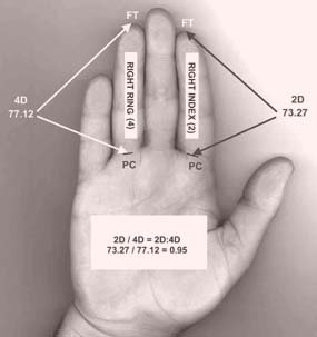 Hoe wordt de '2D:4D digit ratio' gemeten?