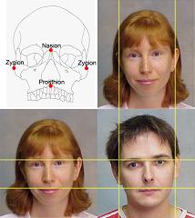 2D:4D and Sexually Dimorphic Facial Characteristics.