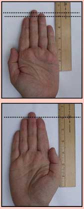 Finger Length & Arthritis