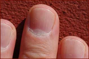 Use of human nails as bio-indicators for heavy metals environmental exposure!