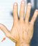 7 Hand characteristics in Obsessive Compulsive Disorder.