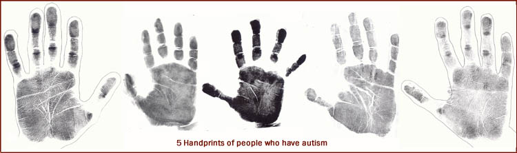 5 Handprints of people who have autism.