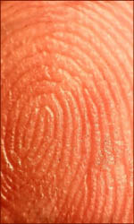 Dermatoglyphic skin ridges: a whorl fingerprint.