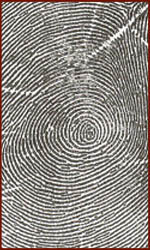 Dermatoglyphic whorl on the hypothenar - print.