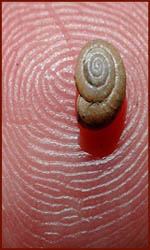 Dermatoglyphic whorl on the hypothenar.