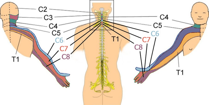 Hand dermatomes & spinal nerve connection.