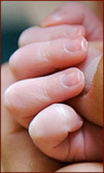Hand of child: what is a common disorder in fingernails?