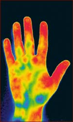 Infrared picture of the human hand: temperature distribution.