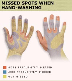 Missed spots during hand washing.