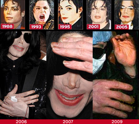 Michael Jackson's fingernails in time - a photo essay.