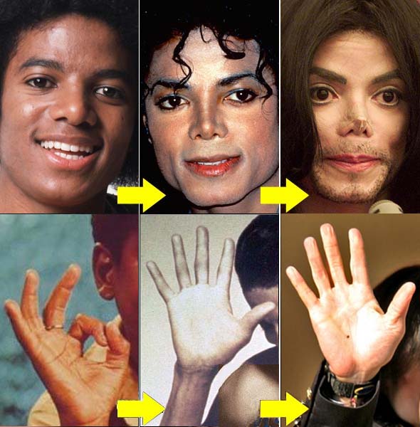 Rosto de Michael Jackson e do lado direito ao longo dos anos.