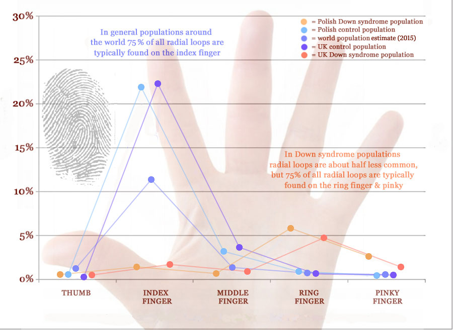 Radial loop fingerprint distribution across fingers in Down syndrome.