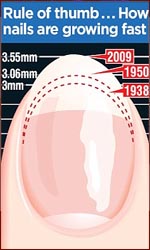 Fingernails grow faster on a proteine diet.