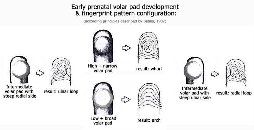 Early prenatal volar pad shape & fingerprint pattern configuration: arch, ulnar loop, radial loop & whorl.