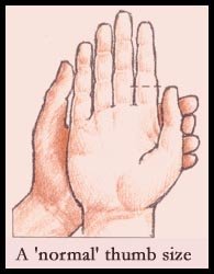 Normal thumb length (size).