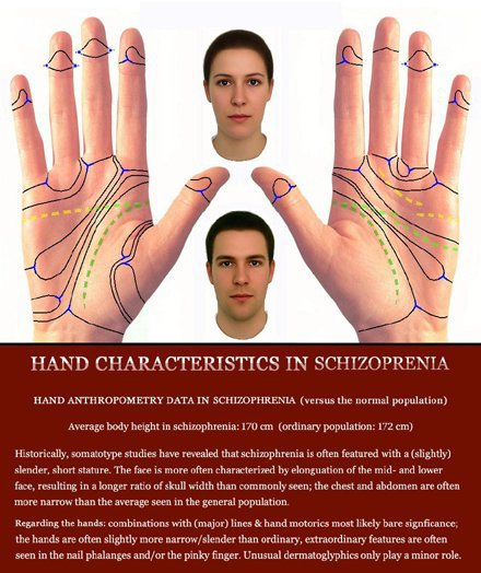 Phantom picture for the hand in schizophrenia: hand anthropometry + dermatoglyphics + major palmar lines.