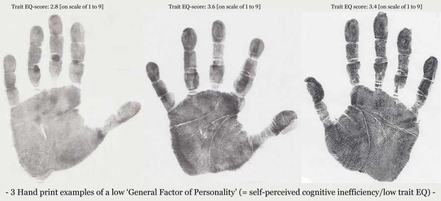 5 Hand signs significant for a low 'General Factor of Personality'.