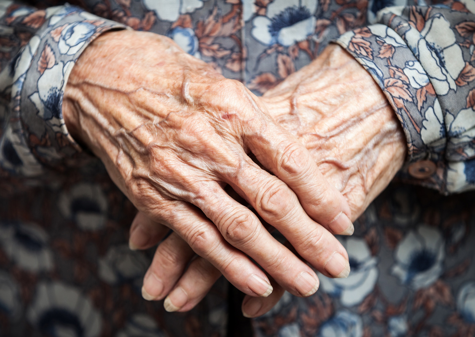 The hands of Emma Morano's hands at age 115 (february 2015)