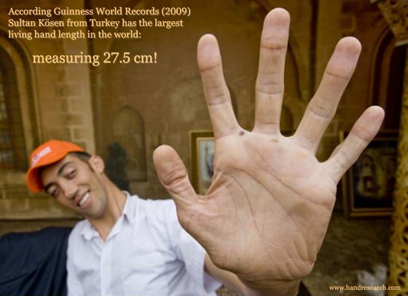 Guinness World Records: Sultan Ksen has the world's largest living hand!