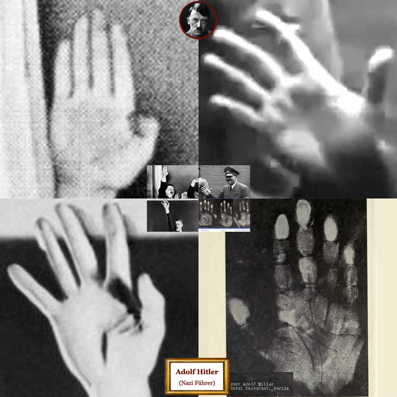 Adolf Hitler hand shape assessment.