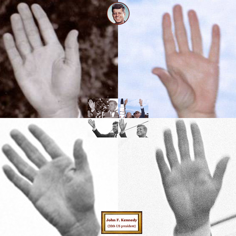 35th US president John F. Kennedy: hand shape impressions.